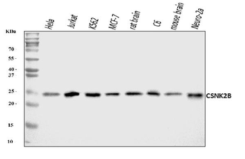 CSNK2B Antibody