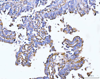 Collagen VI/COL6A2 Antibody