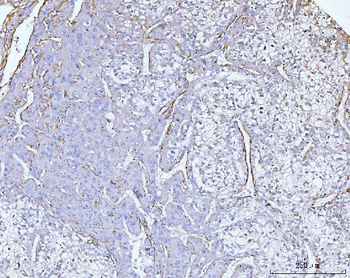 Collagen VI/COL6A2 Antibody