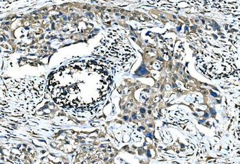 Calponin 2/CNN2 Rabbit Polyclonal Antibody