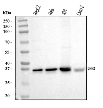 Calponin 2/CNN2 Rabbit Polyclonal Antibody