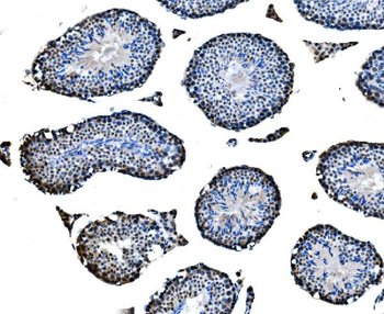 CBX2 Rabbit Polyclonal Antibody