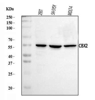 CBX2 Rabbit Polyclonal Antibody