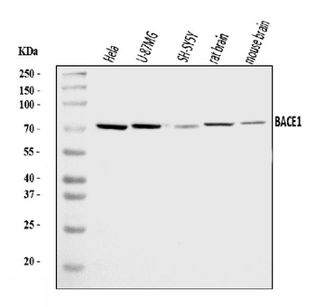 BACE1 Rabbit Polyclonal Antibody