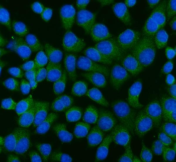 RAGE/AGER Rabbit Polyclonal Antibody