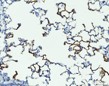 RAGE/AGER Rabbit Polyclonal Antibody