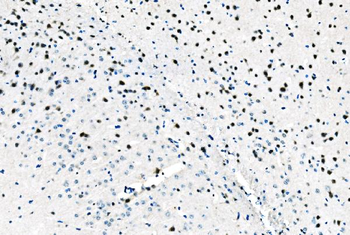 ADAR1/ADAR Rabbit Polyclonal Antibody