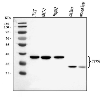 TTPA/TPP1 Rabbit Polyclonal Antibody