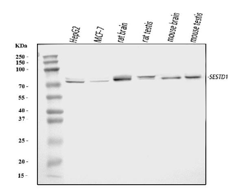 Solo/SESTD1 Rabbit Polyclonal Antibody