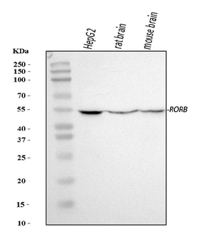 ROR beta/RORB Rabbit Polyclonal Antibody