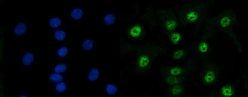 RAD50 Rabbit Polyclonal Antibody