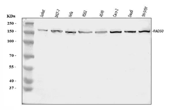 RAD50 Rabbit Polyclonal Antibody