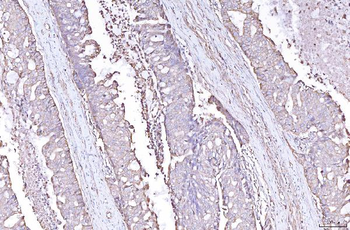 PLP2 Rabbit Polyclonal Antibody