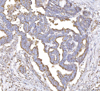 PLP2 Rabbit Polyclonal Antibody