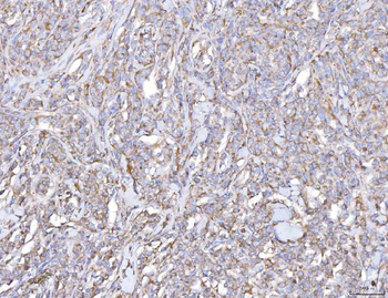 PLP2 Rabbit Polyclonal Antibody