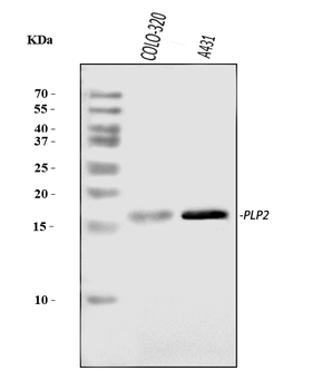 PLP2 Rabbit Polyclonal Antibody