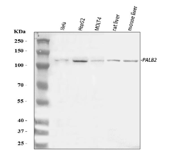 PALB2 Rabbit Polyclonal Antibody