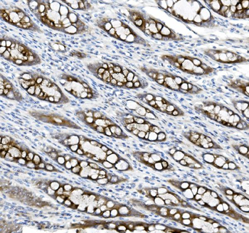 MUC5B Rabbit Polyclonal Antibody