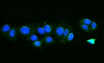 TTC11/FIS1 Rabbit Polyclonal Antibody