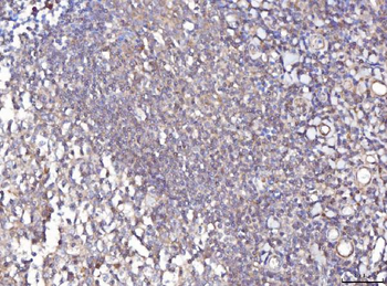 TTC11/FIS1 Rabbit Polyclonal Antibody