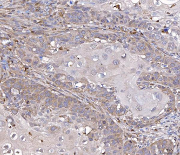 TTC11/FIS1 Rabbit Polyclonal Antibody