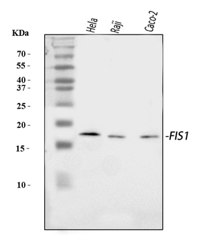 TTC11/FIS1 Rabbit Polyclonal Antibody