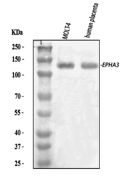Eph receptor A3/EPHA3 Rabbit Polyclonal Antibody