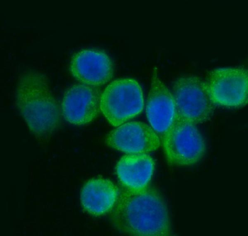 EIF5A Antibody