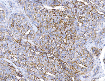 ENPP1/PC1 Antibody