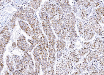 E2F3 Rabbit Polyclonal Antibody