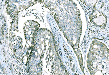 CD101 Rabbit Polyclonal Antibody