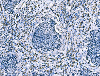CD101 Rabbit Polyclonal Antibody