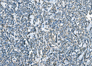 CCR2 Antibody