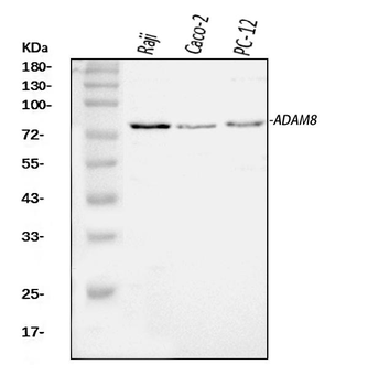MS2/ADAM8 Rabbit Polyclonal Antibody
