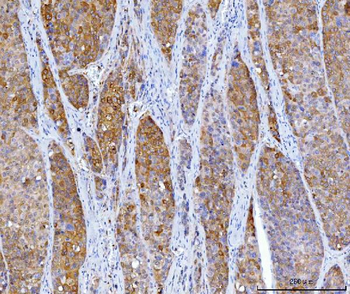 HGD Mouse Monoclonal Antibody