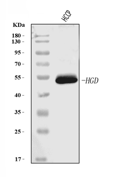 HGD Mouse Monoclonal Antibody