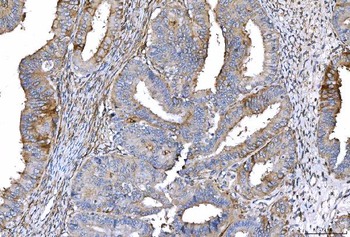 CD55 Mouse Monoclonal Antibody