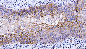 CD55 Mouse Monoclonal Antibody