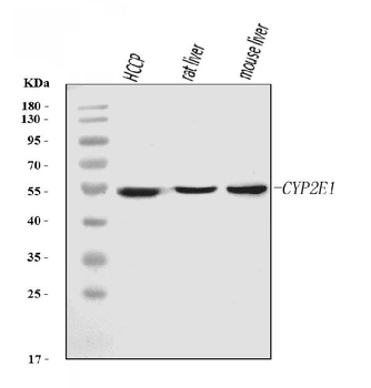 Cytochrome P450 2E1/CYP2E1 Mouse Monoclonal Antibody