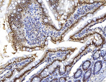 HNF-4-alpha/HNF Mouse Monoclonal Antibody