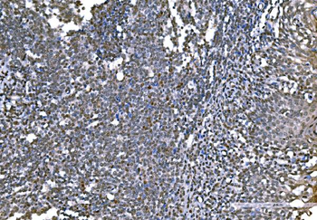 Histone H1.0/H1F0 Antibody (monoclonal, 5I3E6)