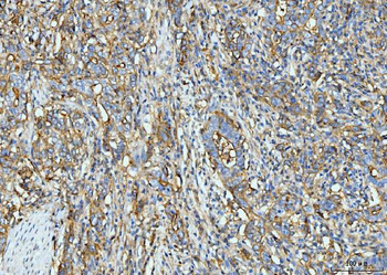 ICAM1 Antibody (monoclonal, 6F2C3)