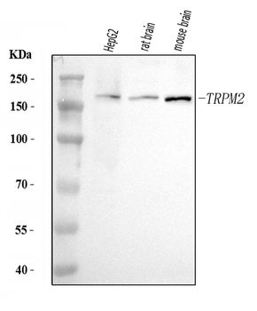 TRPM2 Rabbit Polyclonal Antibody