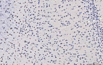 TPR Rabbit Polyclonal Antibody