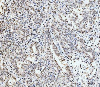 53BP1/TP53BP1 Antibody