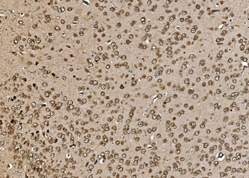 Proteasome 20S beta 7/PSMB7 Rabbit Polyclonal Antibody