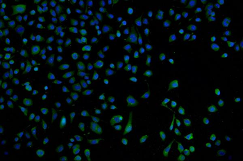 Proteasome 20S beta 7/PSMB7 Rabbit Polyclonal Antibody