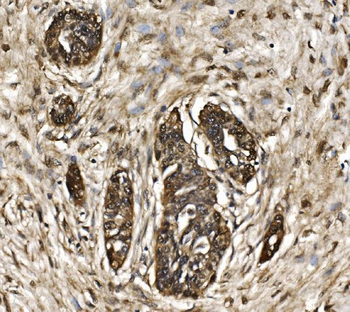Proteasome 20S beta 7/PSMB7 Rabbit Polyclonal Antibody