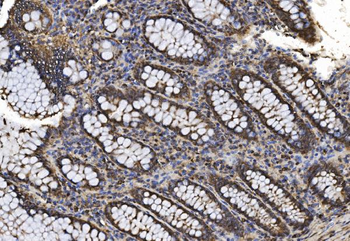 Proteasome 20S beta 7/PSMB7 Rabbit Polyclonal Antibody