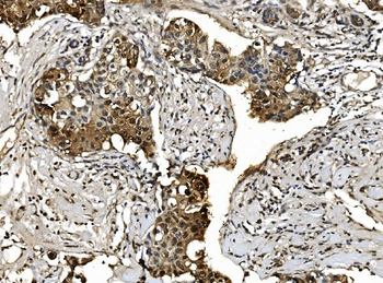 Proteasome 20S beta 7/PSMB7 Rabbit Polyclonal Antibody